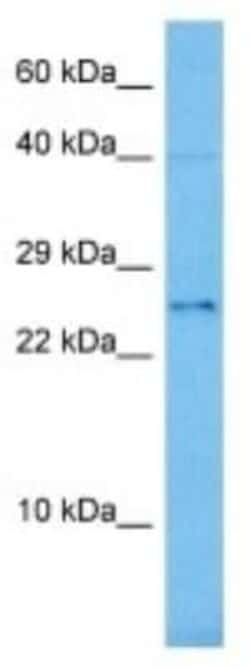 Octapeptide-repeat protein T2 Rabbit anti-Mouse, Polyclonal, Novus Biologicals 100 &mu;g | Buy Online | Novus Biologicals | Fisher Scientific